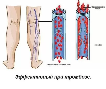 Эффективный при трамбозе